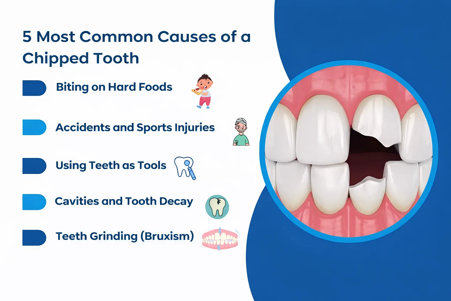  common cases of chipped tooth